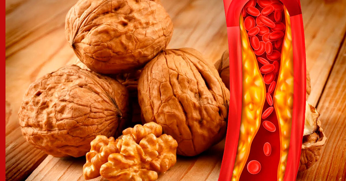 Защитить орехи. Орехи которые помогаю снизить холестерин.
