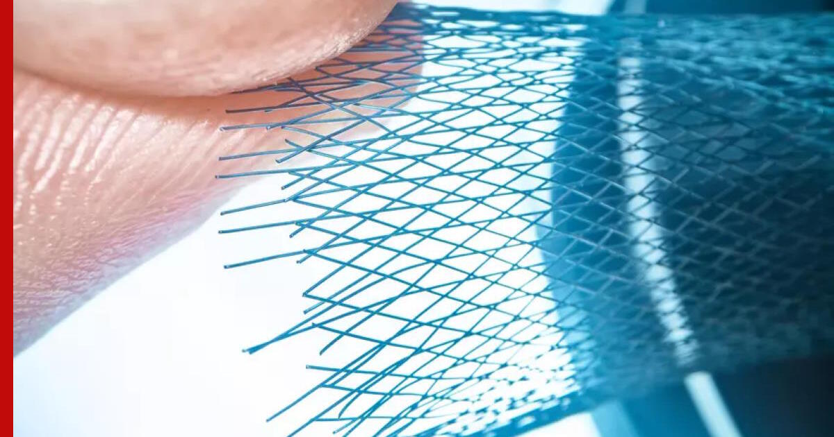 В Москве будут выпускать импланты из титановой сетки