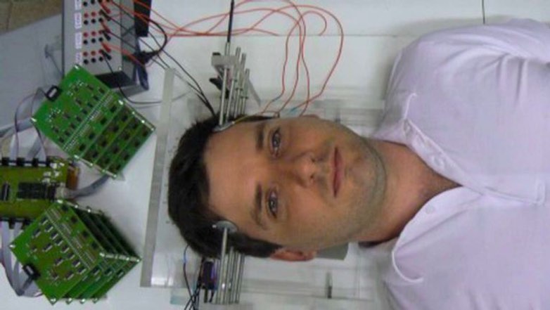 Эпилептические припадки будут лечить электричеством