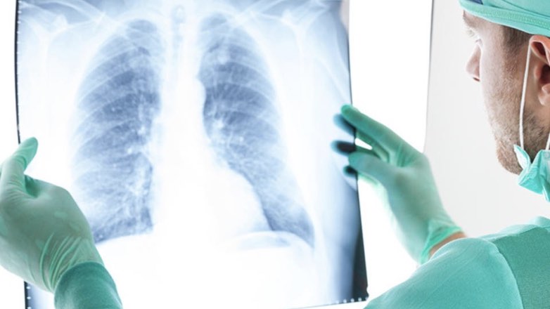 Рентгенологи рассказали об опасности диагностических процедур