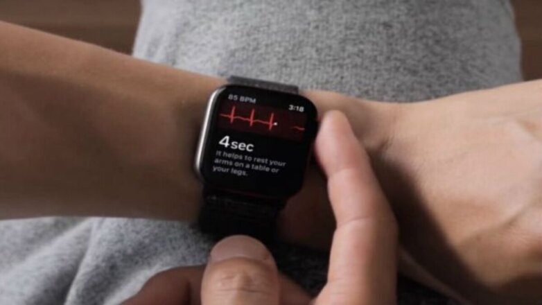 Новые смарт-часы Oppo получат редкую функцию