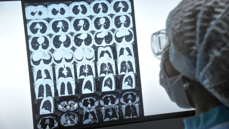 Эксперты назвали главные мишени COVID-19 в организме человека