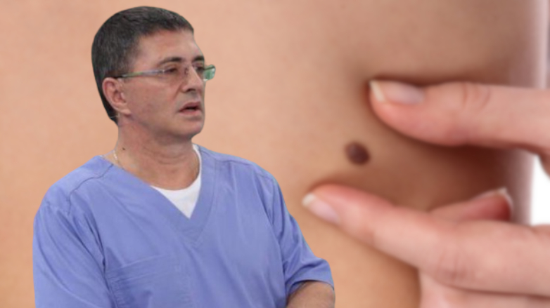 Врач рассказал, как распознать опасные родинки