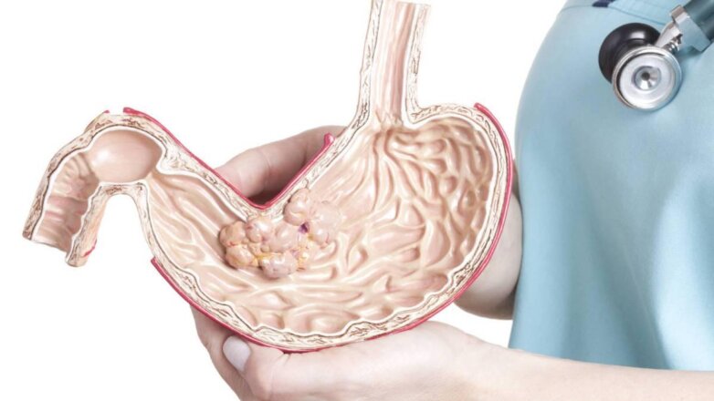Медики рассказали о влиянии стресса на здоровье желудка