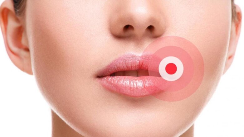 Рак ротовой полости поможет выявить двухминутная проверка