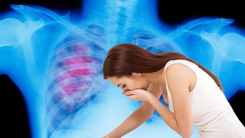 Медики назвали неприятный и «внезапный» симптом рака легких