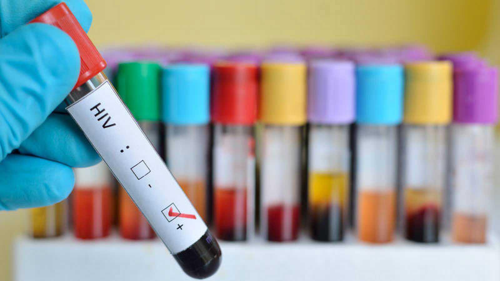 Австралия остановила испытания вакцины от COVID-19 из-за ВИЧ-результатов