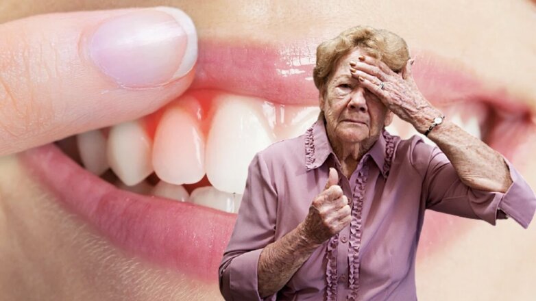 Риск развития деменции связали с состоянием десен