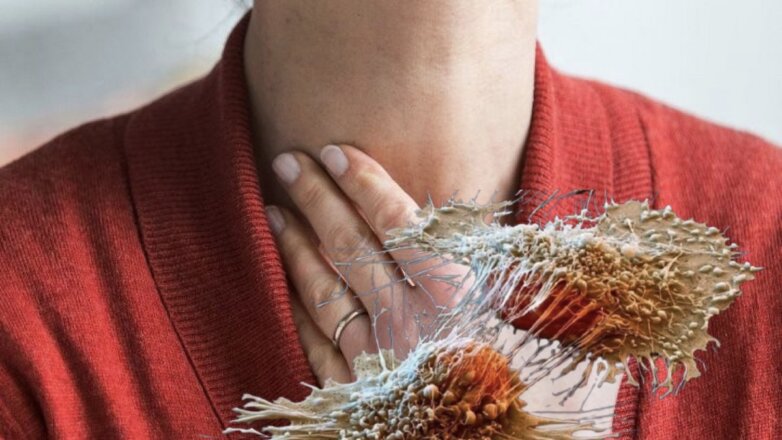 Как выявить опухоль: частые признаки рака щитовидной железы, которые можно упустить