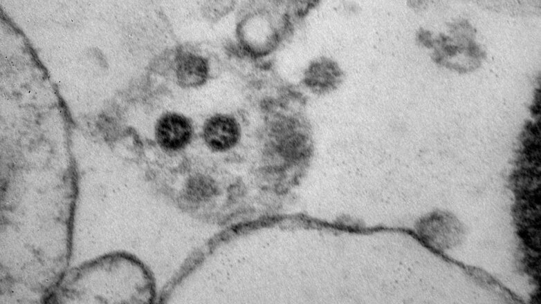 Российские ученые показали фотографии омикрон-штамма COVID-19