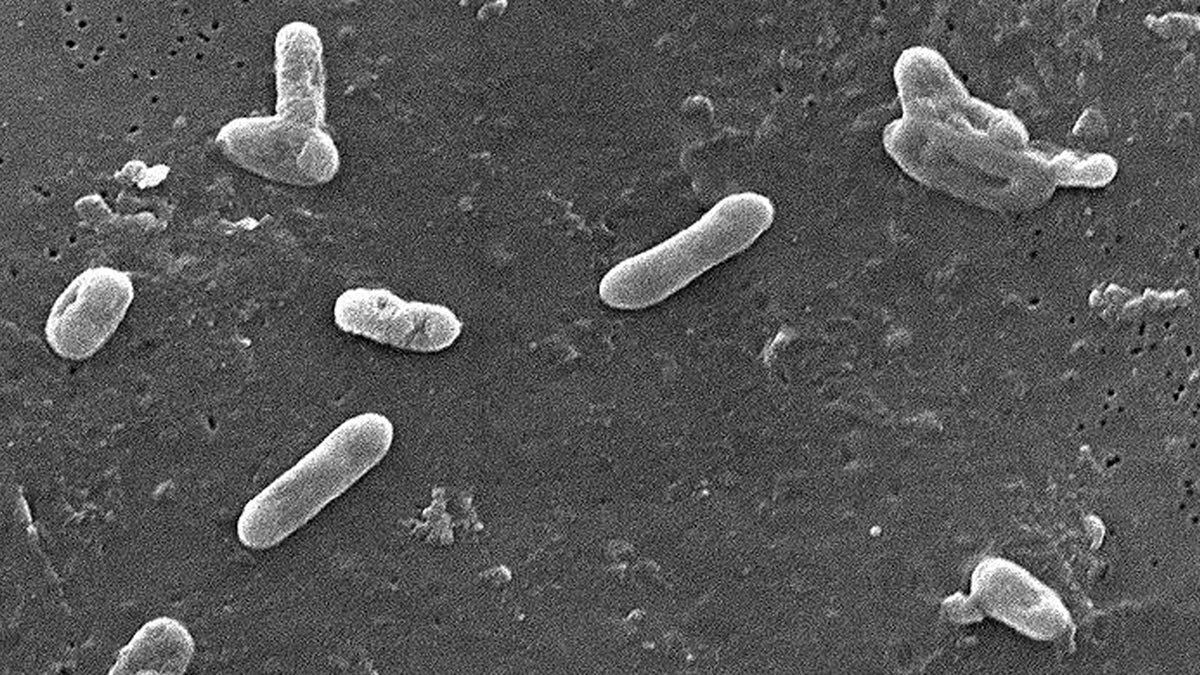 Возбудитель коклюша Bordetella pertussis