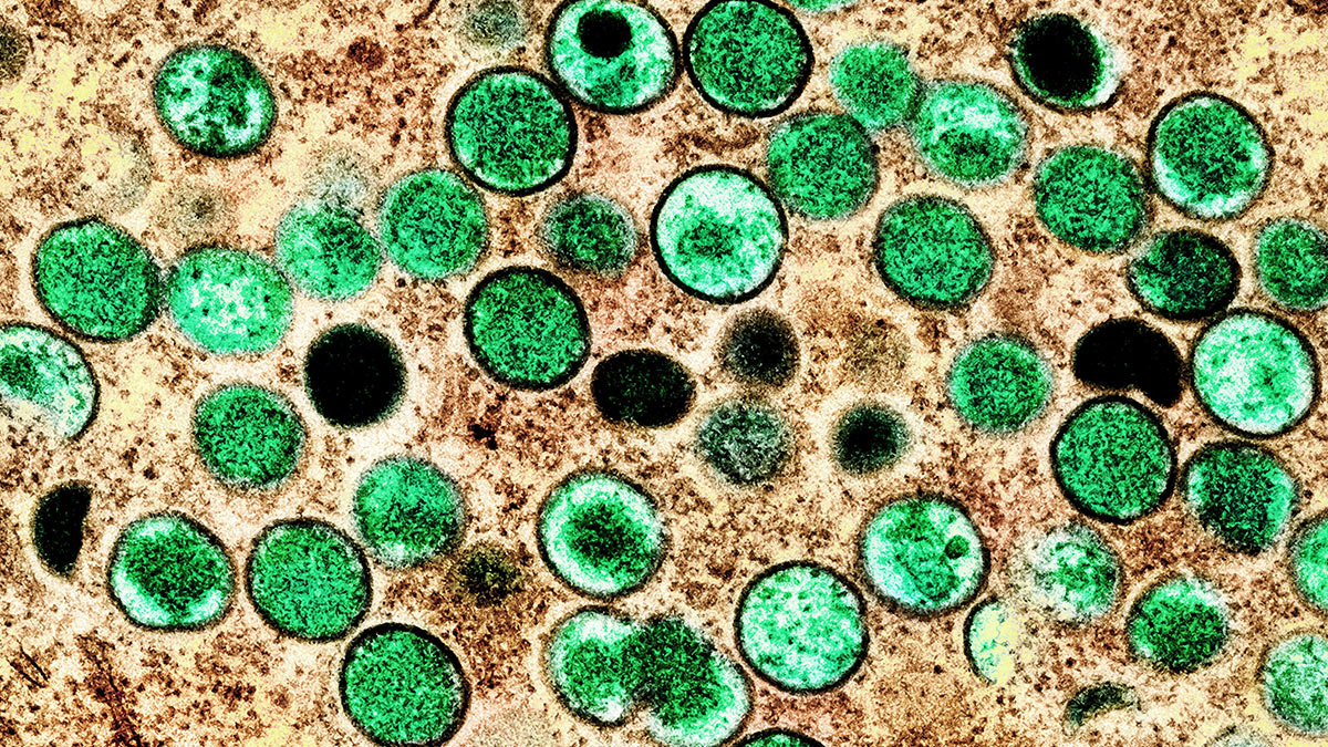 Трансмиссионная электронная микрофотография вирусов оспы обезьян в пораженной клетке