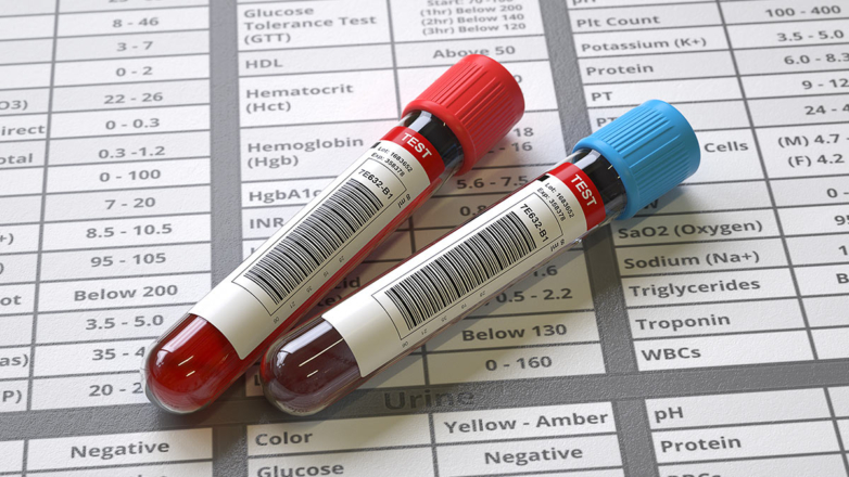 Ситуация с зараженной кровью в Великобритании: что известно о скандале