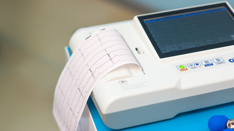 Умный кардиограф с ИИ-диагностикой разработали в Нижнем Новгороде