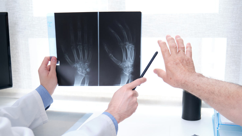 Гибкий материал для улучшения качества рентгеновских снимков создали в МГУ