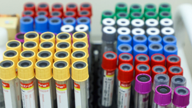 Число людей с ВИЧ в России с начала года выросло на 3%, до 1,25 млн человек