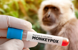 Случай подозрения на оспу обезьян зарегистрировал в Подмосковье Роспотребнадзор